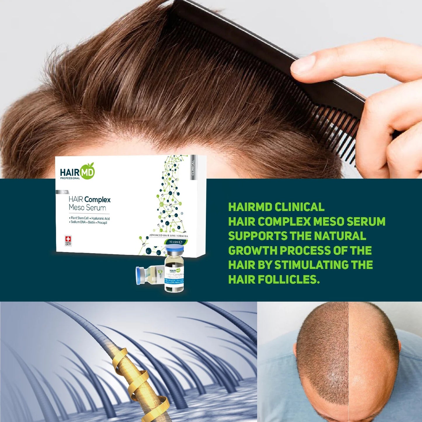 HairMD Dopo Trapianto Capelli Set Siero Meso Anticaduta 10x6ml