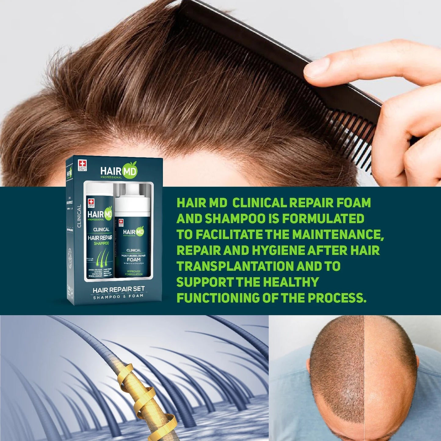 HairMD Clinical Hair Repair Set (Shampoo & Foam)